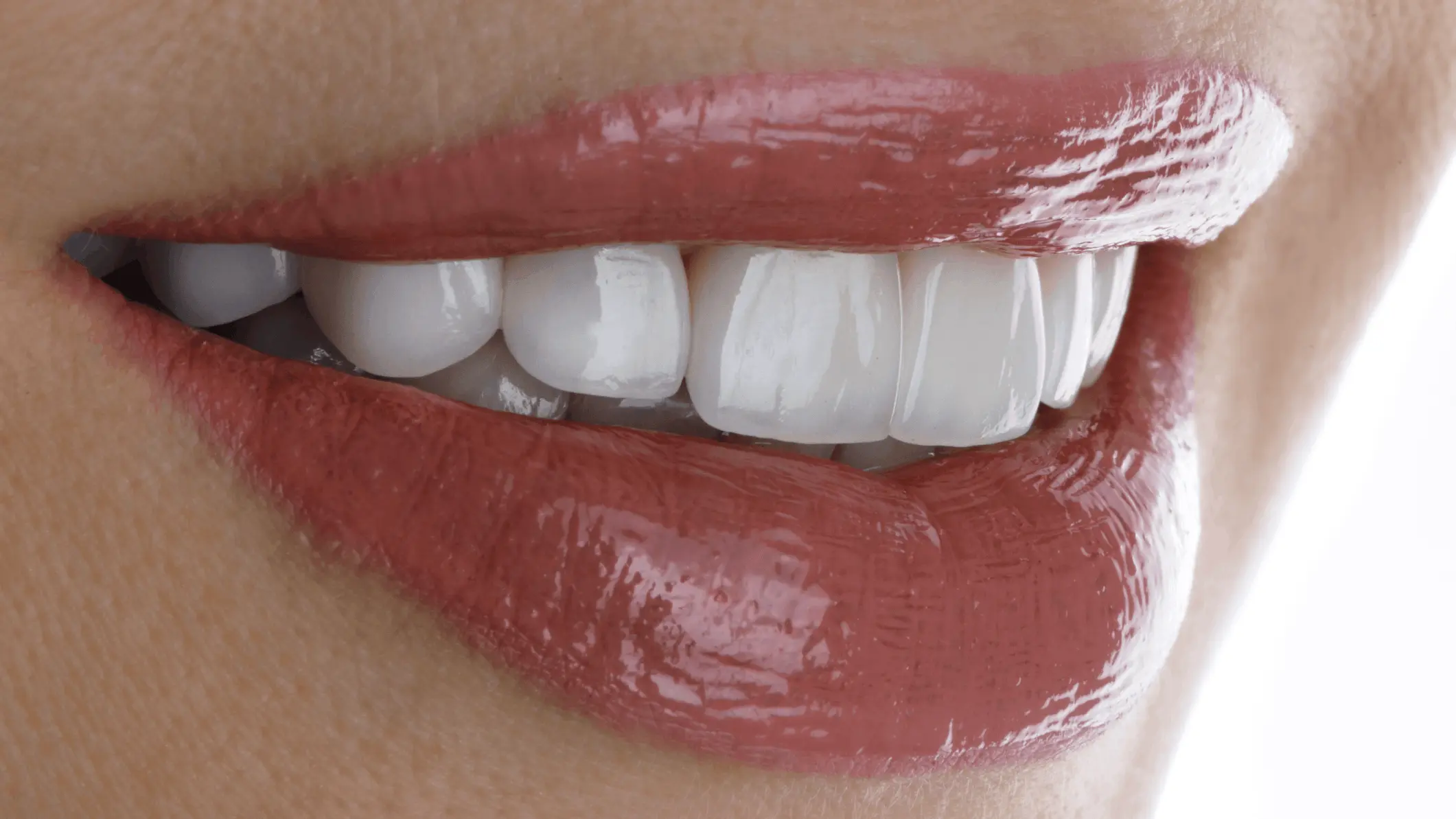 Carilla Dental