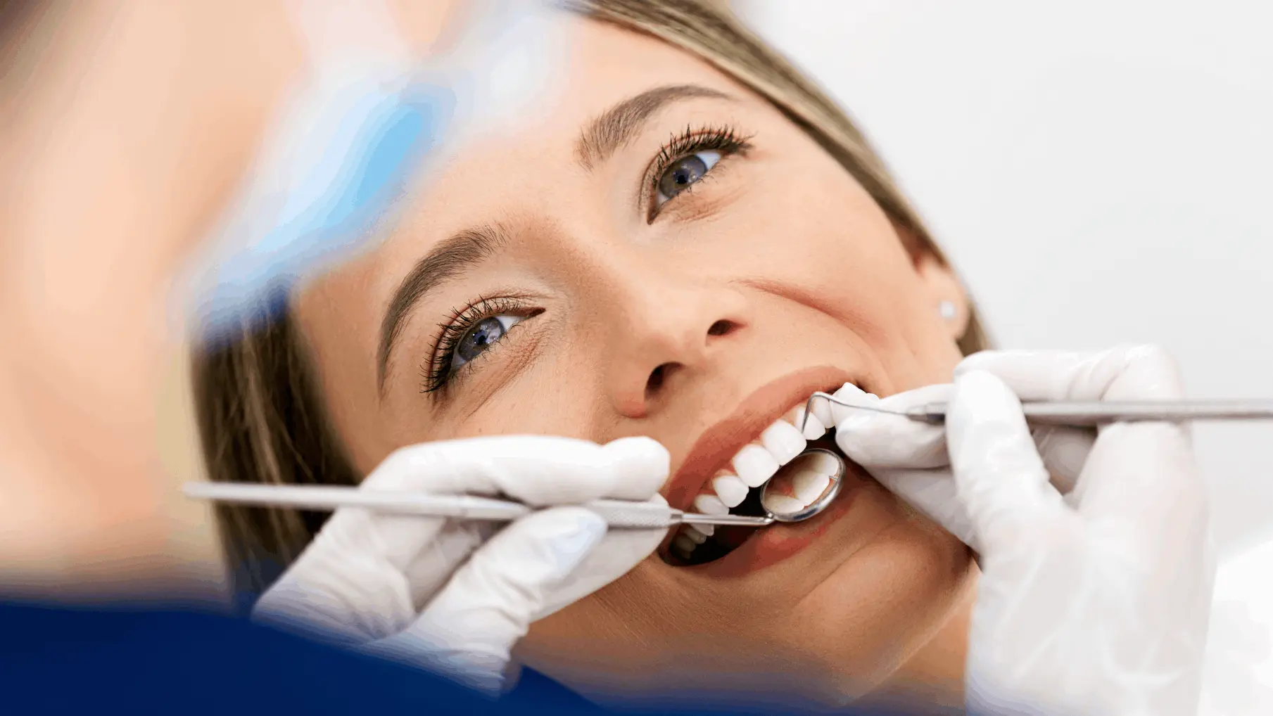 limpieza dental