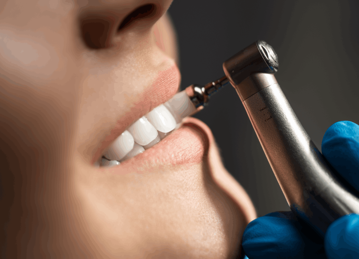 Limpieza bucodental